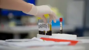 Gant médical manipulant des tubes à essai dans un laboratoire d'analyse médicale.
